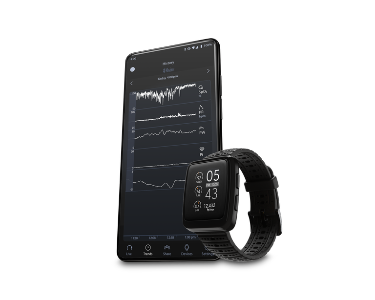 Masimo W1®, , dynamic
